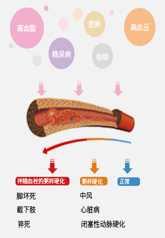 动脉硬化检测仪/动脉检测仪价格/便携式动脉监测仪