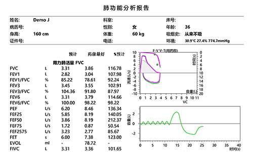 肺功能检测仪报告